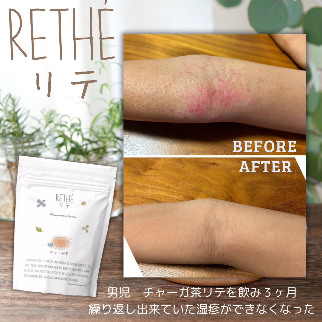 【リジュベネーション】チャーガ